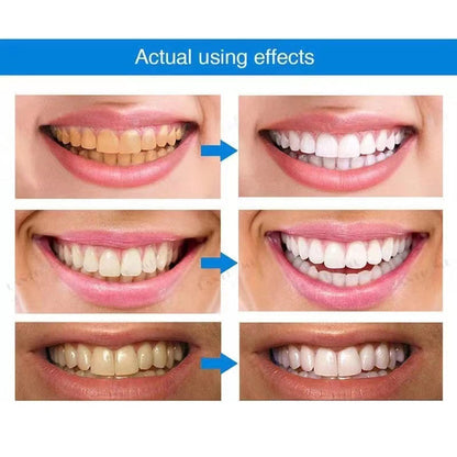 SmileMate™ Teeth Whitening Essence Pen